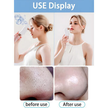 Portable Electric Rechargeable Bubble Blackhead Remover Pore Vacuum Cleaner with Interchangeable Heads