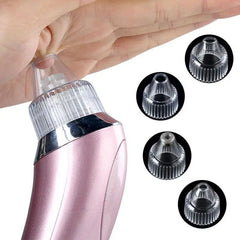 Original 5 in 1 Multi-functional Black Head Removal Machine